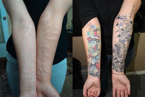 From Scars To Art 92 Inspiring Tattoo Concepts To Renew Your Skins