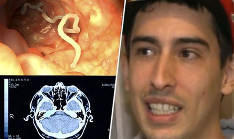 Man Given 30 Minutes To Live After Doctors Find Live Tapeworm In Brain Uk