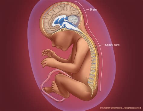 Explore more on spinal cord development below! Spina Bifida Treatment | Midwest Fetal Care Center