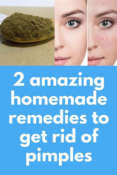 2 Amazing Homemade Remedies To Get Rid Of Pimples Amazing