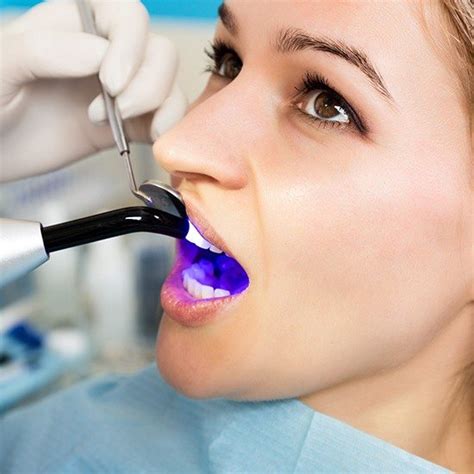 Cosmetic Dentistry Covington La Porcelain Veneers Teeth Whitening