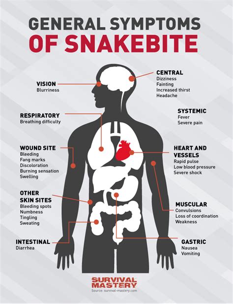 Symptoms Of Snakebite Infographic Visually
