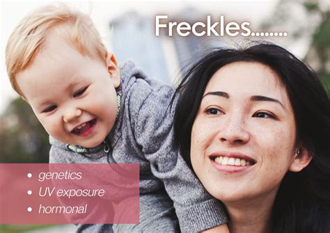 What Is Freckles And What Causes Freckles Eeva Medical Aesthetic Clinic