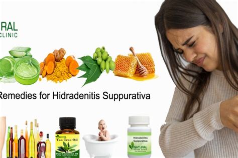 Natural Remedies For Hidradenitis Suppurativa Dubai Entertainment