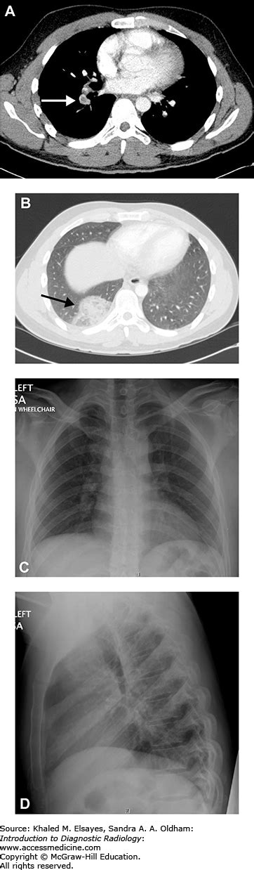 Cardiothoracic Imaging Radiology Key