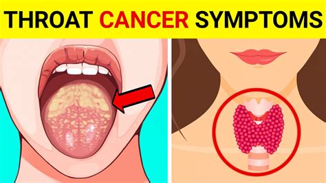 Oral Sex And Throat Cancer Does Oral Sex Cause Throat Cancer