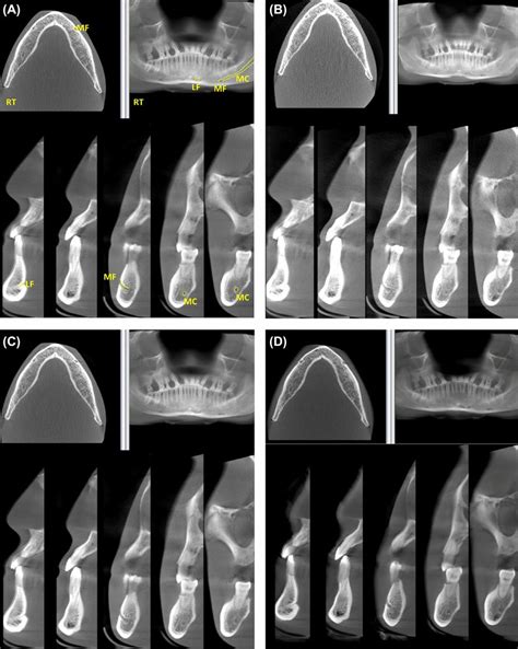 Examples Of Cone Beam Computed Tomography Cbct Images And The