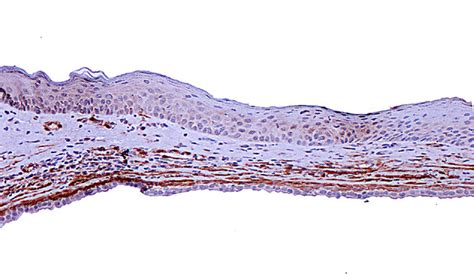 A Case Of Generalised Cutaneous Apocrine Cystomatosis In A Pekingese