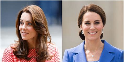 The Palace Denies Kate Middleton Got Botox After Viral Side By Side Picture