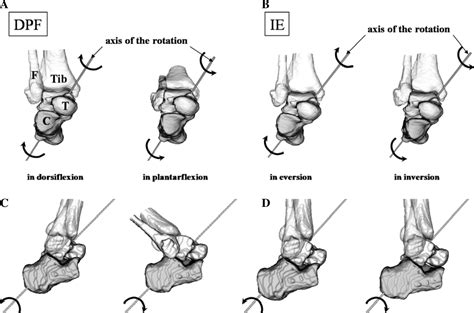 Three Dimensional In Vivo Kinematics Of The Subtalar Joint During Dorsi