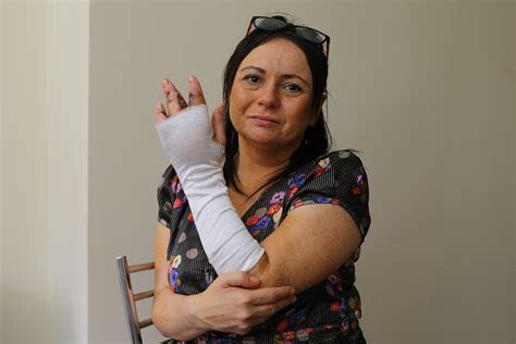 Glasgow Mum Loses Finger And Almost Whole Hand In Deadly Mrsa Cat