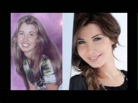 عمليات التجميل وعروض مراكز التجميل في تركيا. فضيحة الفنانات العربيات قبل و بعد عمليات التجميل ...