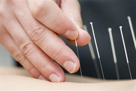 5 Health Benefits Of Acupuncture You Probably Didnt Know About