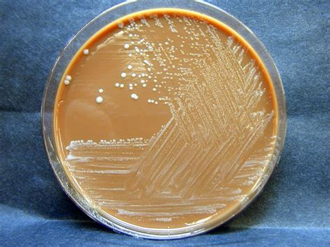 Free Picture Francisella Tularensis Colonies Grown Chocolate Agar