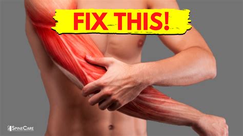 How To Fix Arm Muscle Pain In SECONDS SpineCare