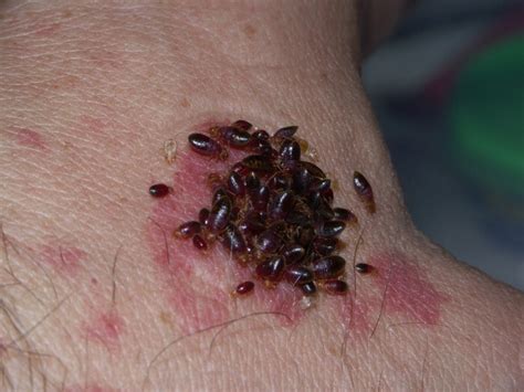 What Do Baby Bed Bugs Look Like Size Color And Bites