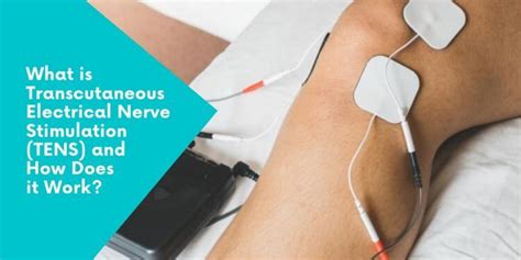 What Is Transcutaneous Electrical Nerve Stimulation Tens And How Does