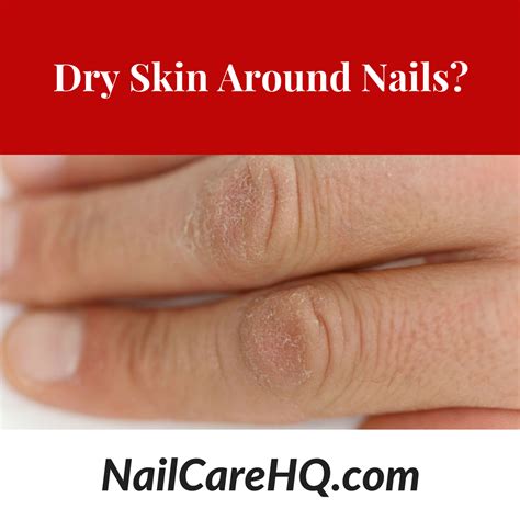 Dry, flaky fingertips aren't just uncomfortable: Ask Ana - How Do I Stop Hard, Dry Skin On Hands ...
