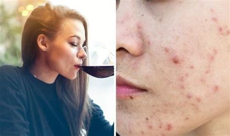 The Four Signs In Your Skin That Suggest Youre Drinking Too Much