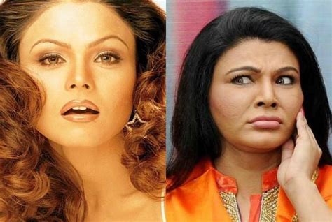 Bollywood Stars Fashions Before And After Cosmetic Surgery