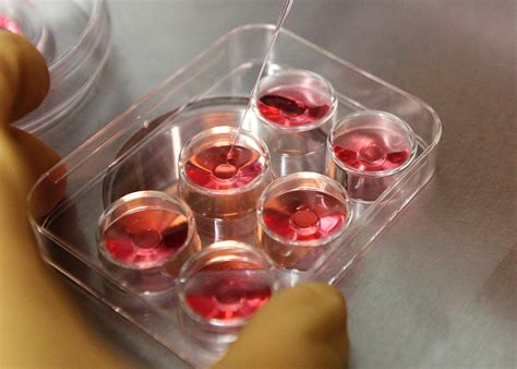 We did not find results for: Egg donation price fixing lawsuit: Did fertility clinics ...