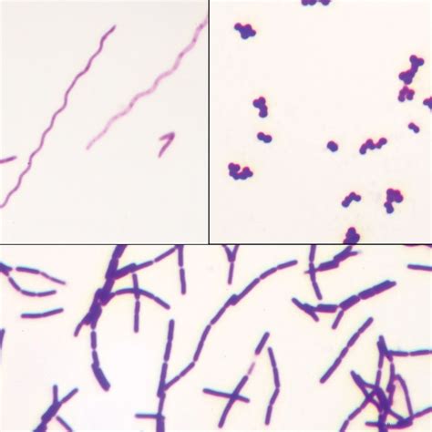 Bacteria Types Slide Separate Smears Gram Stain