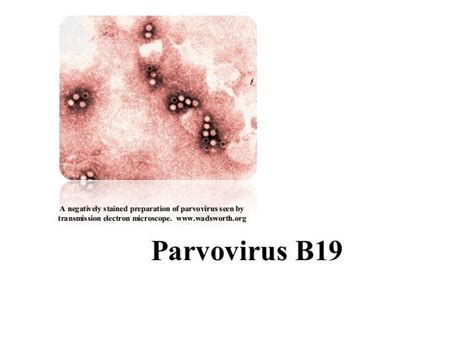 Parvovirus B19