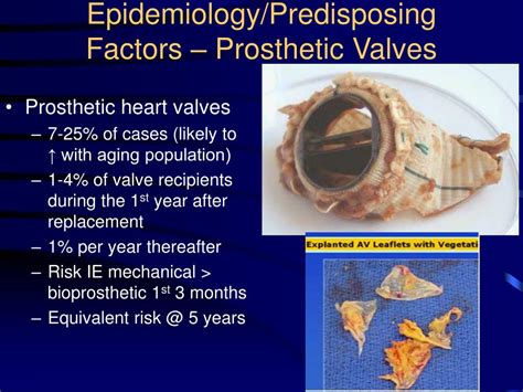 PPT Infective Endocarditis PowerPoint Presentation Free Download ID
