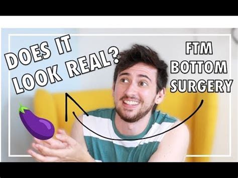 FTM BOTTOM SURGERY Your Questions Answered YouTube