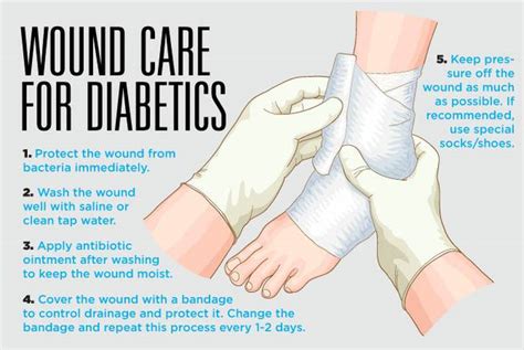 Caring For Wounds And Foot Ulcers In Diabetic Patients Sunrise Hospital