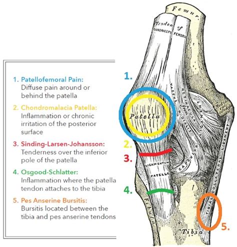Dec 31, 2019 · you may be experiencing knee pain and want to know the possible causes. An Overview of Mechanical Knee Pain - OPEDGE.COM