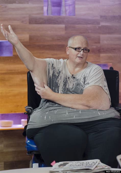 Worlds Fattest Man Drops 46 Stone After Surgery Dbtechno