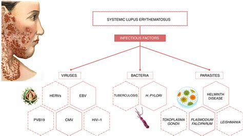Infectious Processes And Systemic Lupus Erythematosus Illescas‐montes