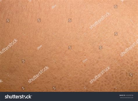 Dry Skin Ichthyosis Detail Stock Photo 163258106 Shutterstock