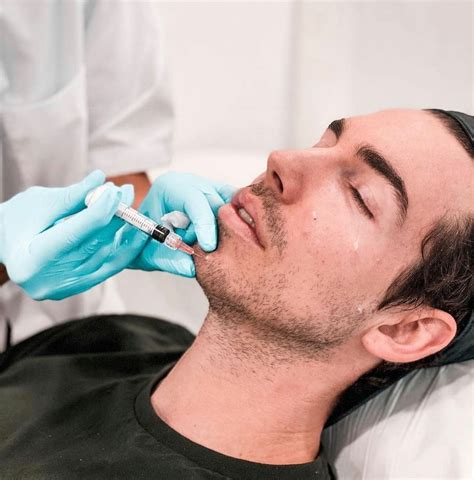 Botox For Men Hamilton Face Clinic