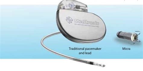 The Medtronic Micra Leadless Pacemaker Dr Oliver Segal