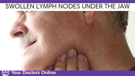 Swollen Lymph Nodes Jaw Images And Photos Finder