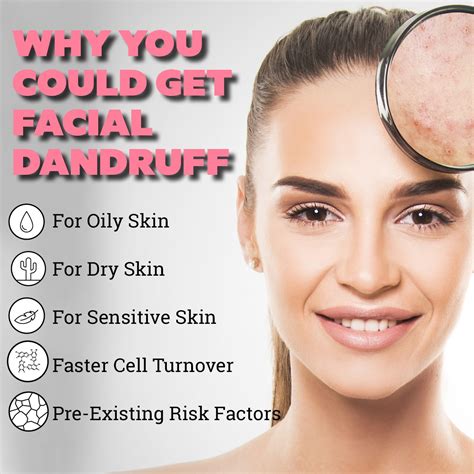 Everything You Need To Know About Facial Dandruff Be Beautiful India