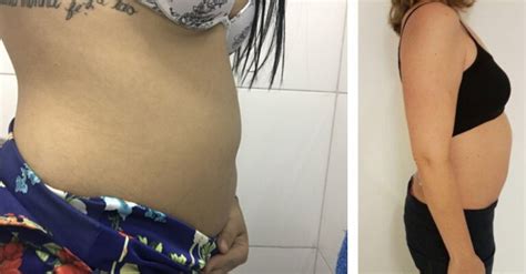 Porque O Estomago Fica Alto