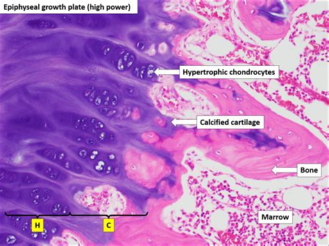 Histology Of Bone Hot Sex Picture