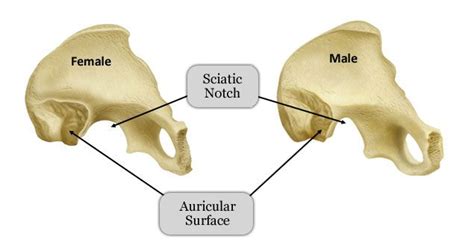 Activity Is The Skeleton Male Or Female Forensic Anthropology
