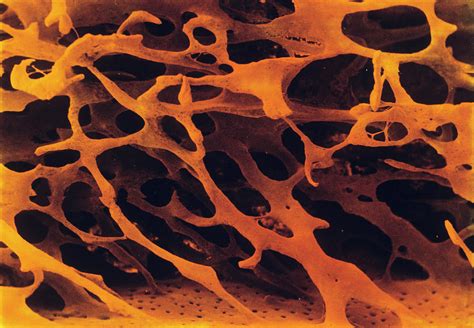 Spongy Bone Tissue Photograph By Cnriscience Photo Library Fine Art