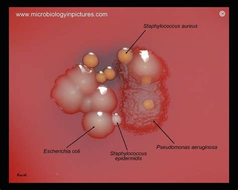 We did not find results for: Bacteria colony morphology | MLT Stuff | Pinterest | Blood ...