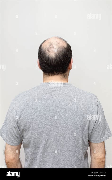 Bald Head Back Of Hi Res Stock Photography And Images Alamy