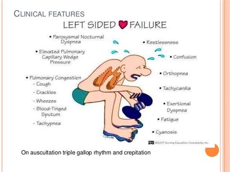 Acute Heart Failure