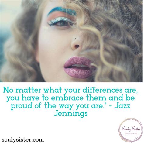 “no matter what your differences are you have to embrace them and be proud of the way you are