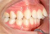 Photos of Orthodontics In Progress