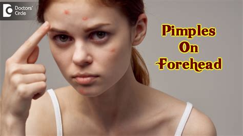 Pimples On Your Forehead Causes And How To Get Rid Of It Dr Urmila