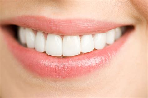 Menjadi populer, veneer gigi pun memiliki banyak penggemar. Dijamin, Kamu Pasti Belum Tahu 7 Fakta Veneer Gigi Ini ...