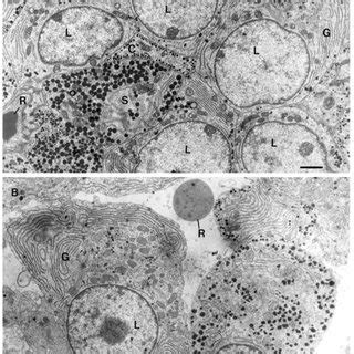 Electron Micrograph Of The Female Anterior Pituitary Gland A In Wt